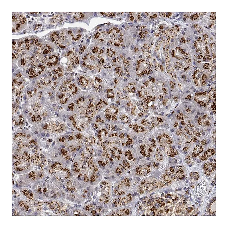 Atlas Antibodies Anti-YIPF3 Antibody