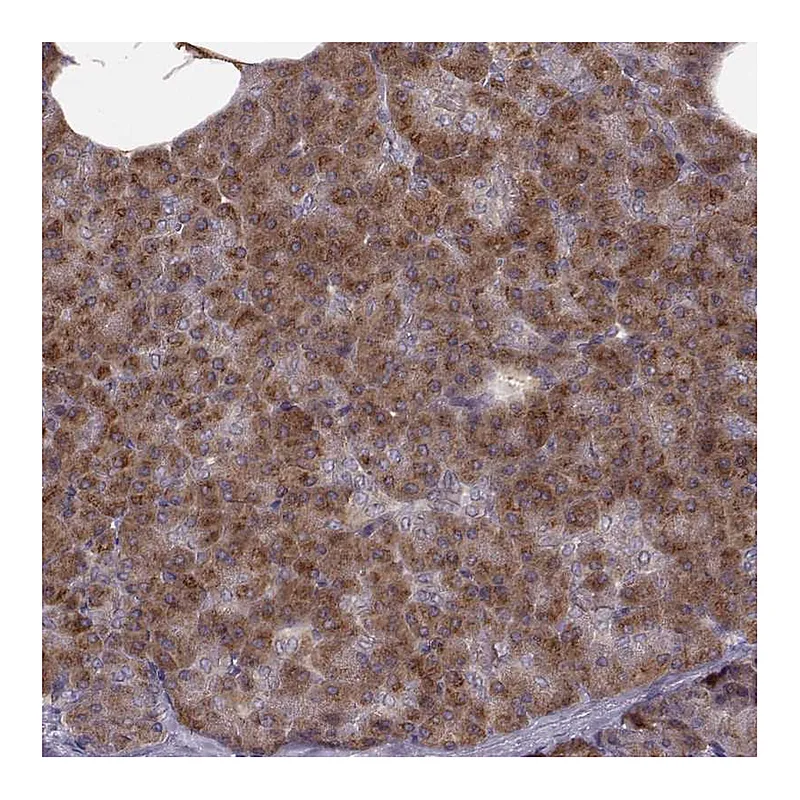 Atlas Antibodies Anti-YIPF5 Antibody