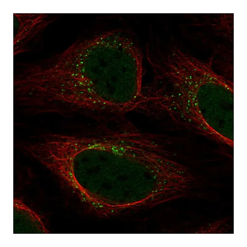 Atlas Antibodies Anti-YIPF5 Antibody