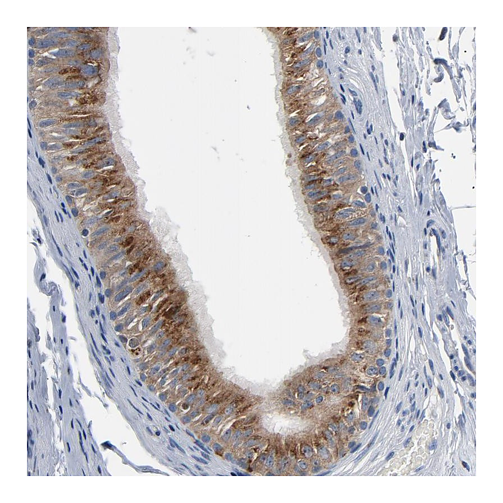 Atlas Antibodies Anti-YIPF6 Antibody