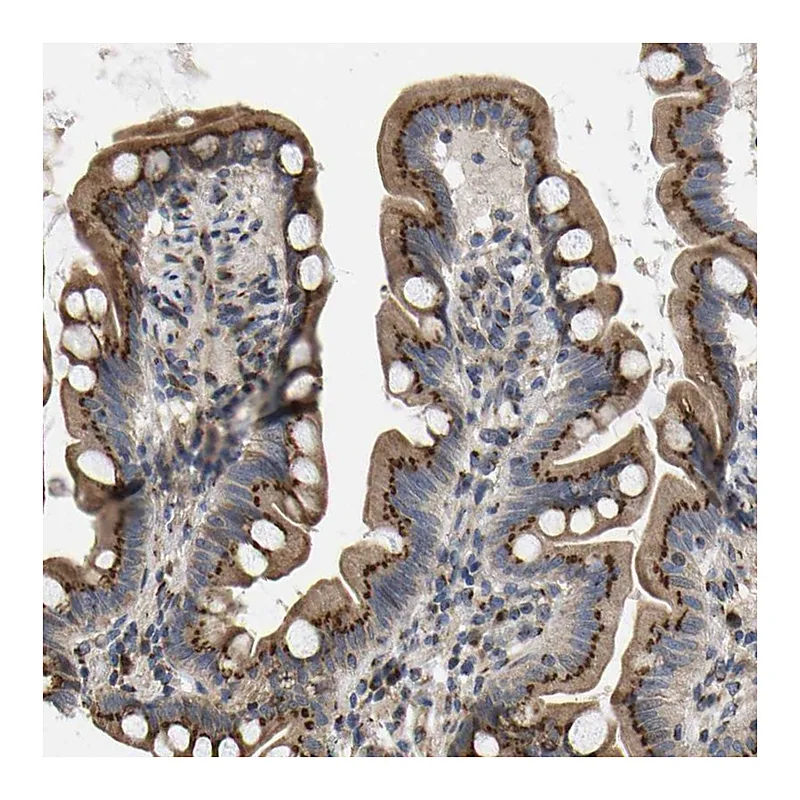 Atlas Antibodies Anti-YIPF4 Antibody