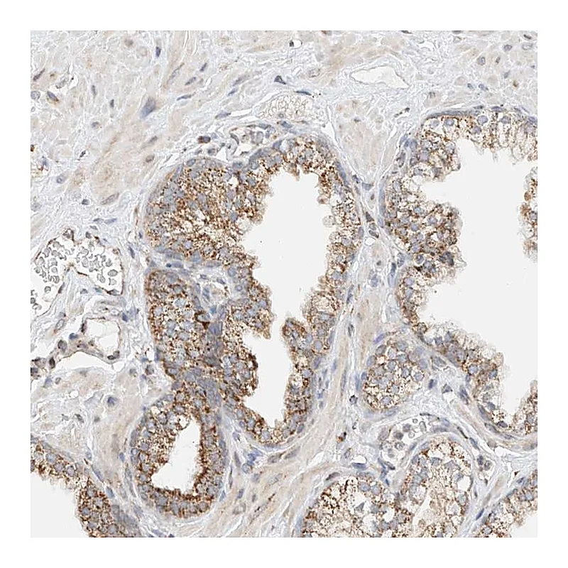 Atlas Antibodies Anti-YIPF7 Antibody