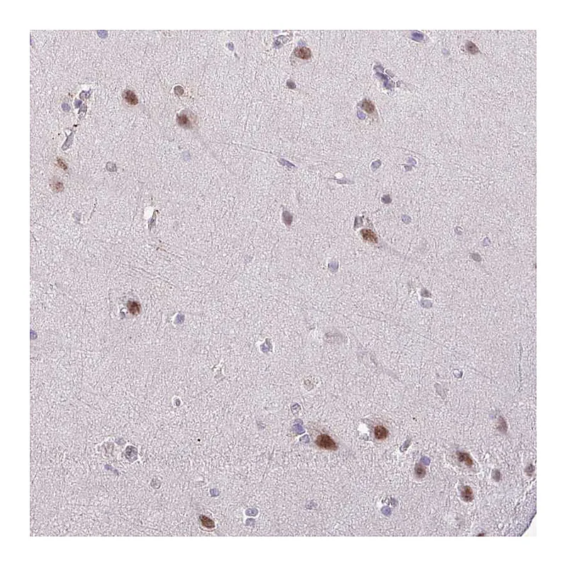 Atlas Antibodies Anti-YLPM1 Antibody