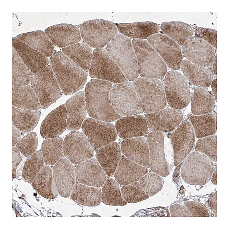 Atlas Antibodies Anti-YKT6 Antibody