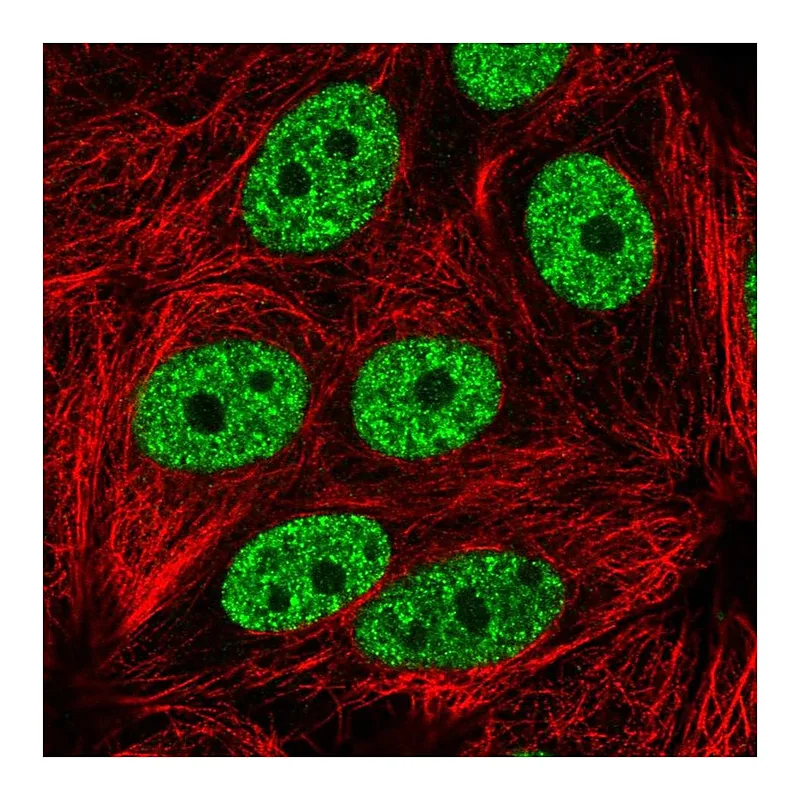 Atlas Antibodies Anti-YLPM1 Antibody