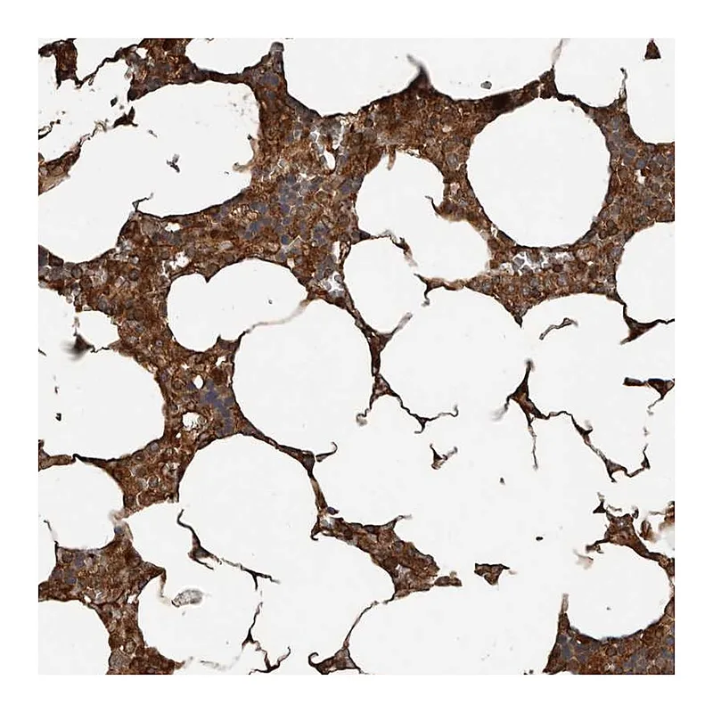 Atlas Antibodies Anti-YOD1 Antibody