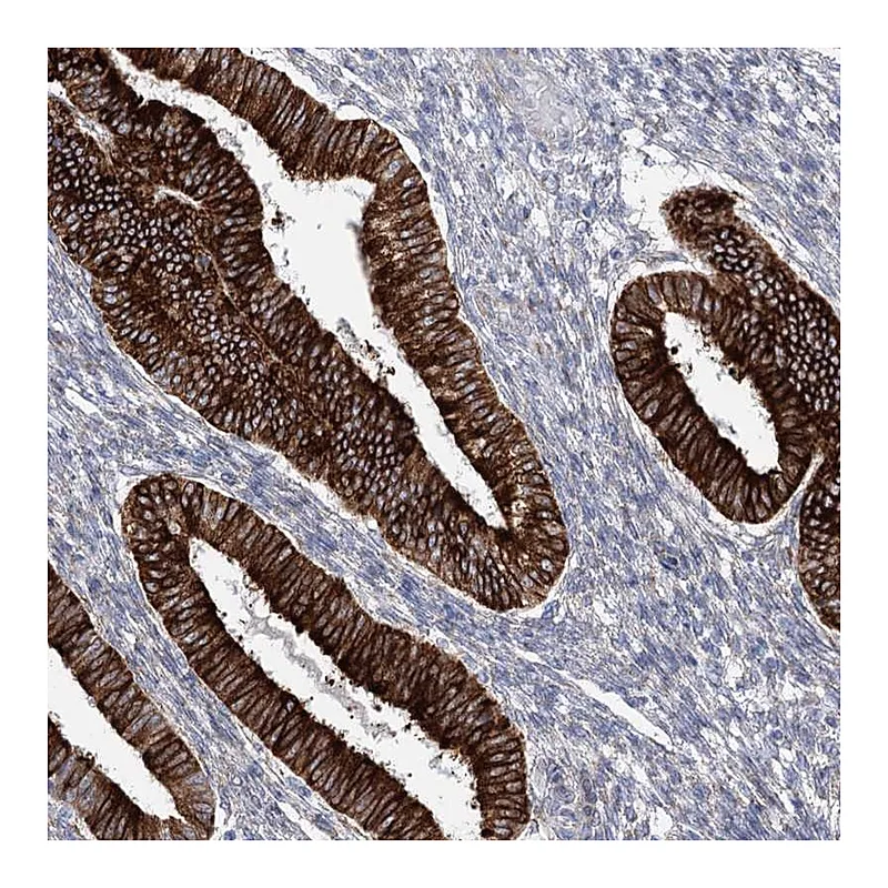 Atlas Antibodies Anti-YTHDC2 Antibody