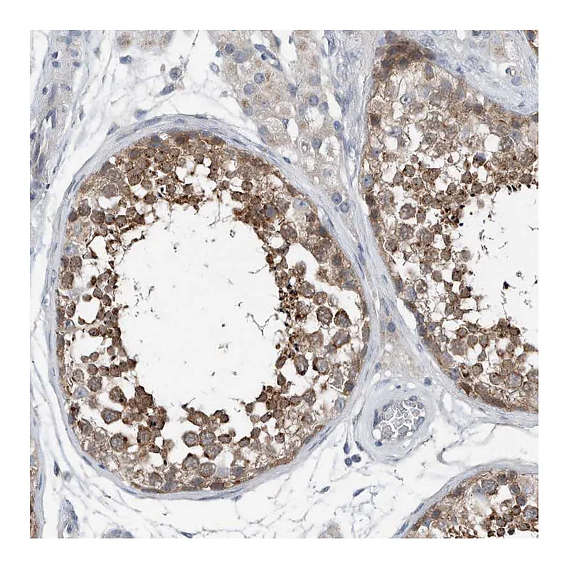 Atlas Antibodies Anti-YRDC Antibody