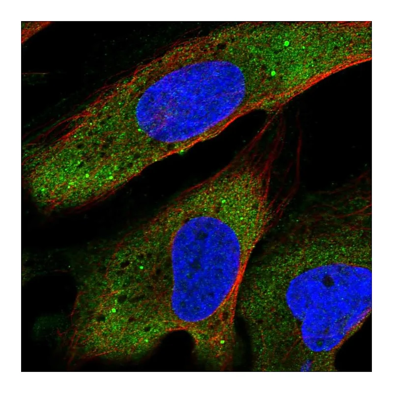 Atlas Antibodies Anti-YTHDF2 Antibody