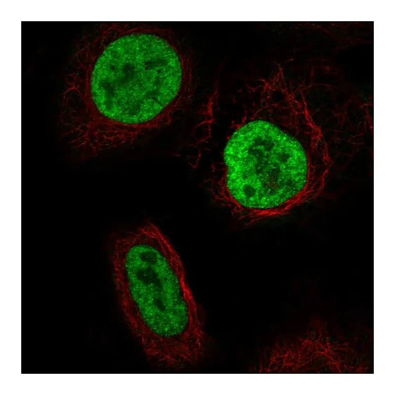 Atlas Antibodies Anti-YTHDC2 Antibody