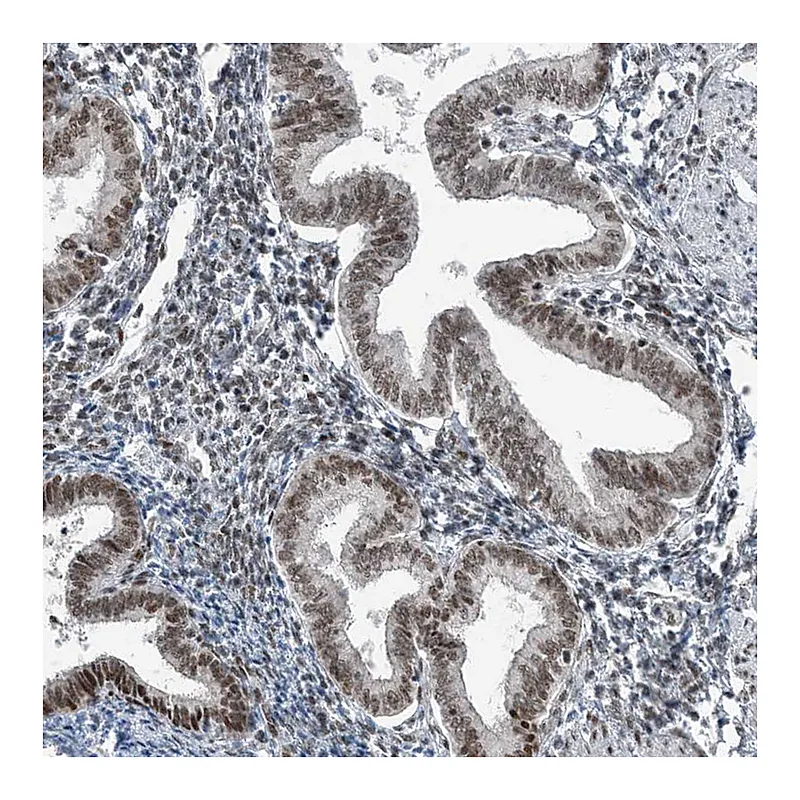 Atlas Antibodies Anti-YTHDC1 Antibody