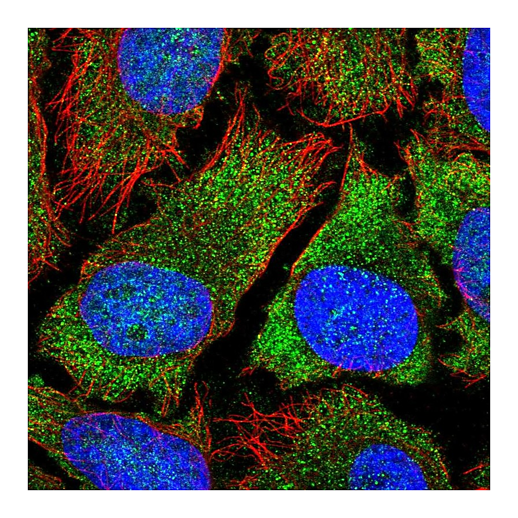 Atlas Antibodies Anti-YTHDF2 Antibody