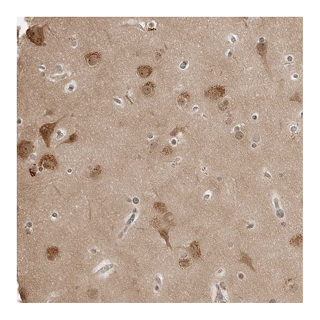 Atlas Antibodies Anti-YWHAG Antibody