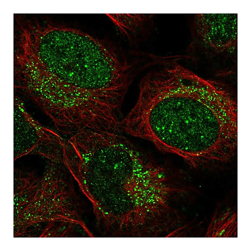 Atlas Antibodies Anti-ZADH2 Antibody