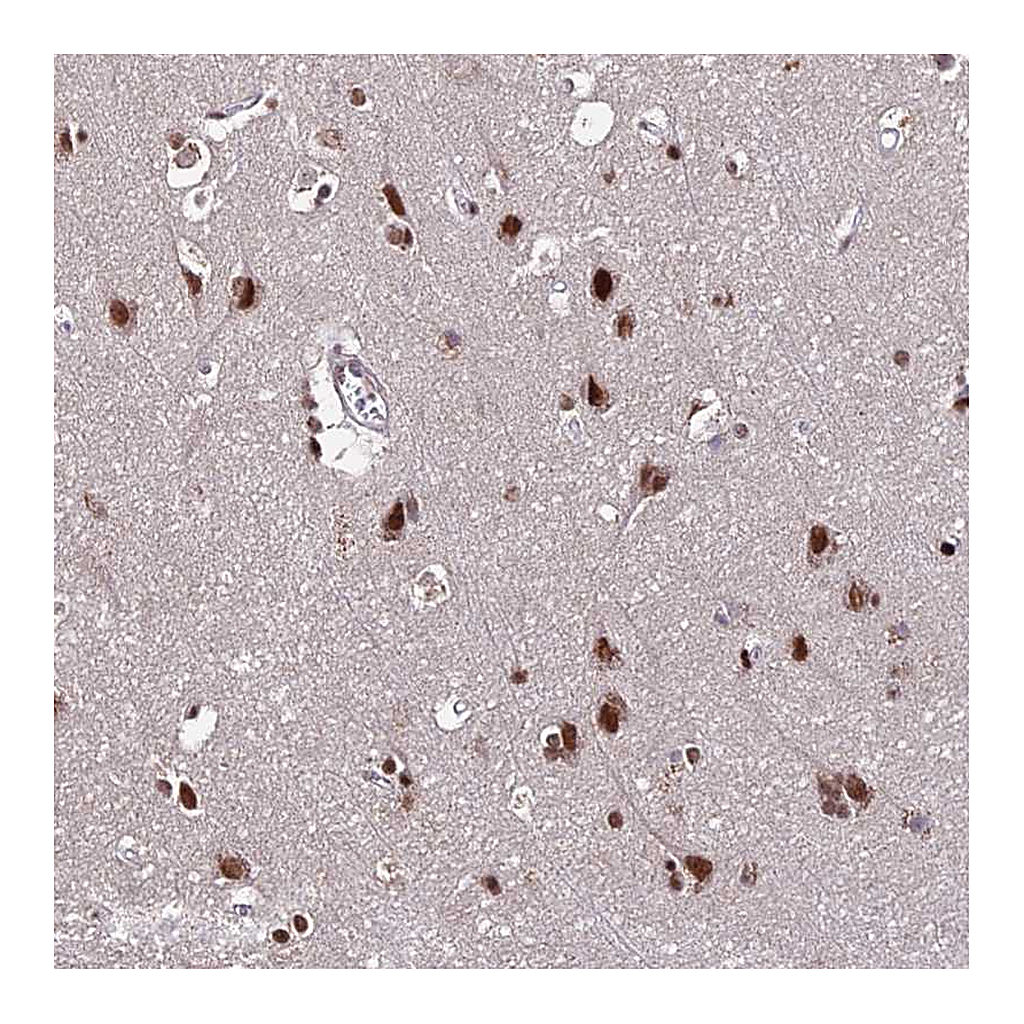 Atlas Antibodies Anti-ZBED4 Antibody