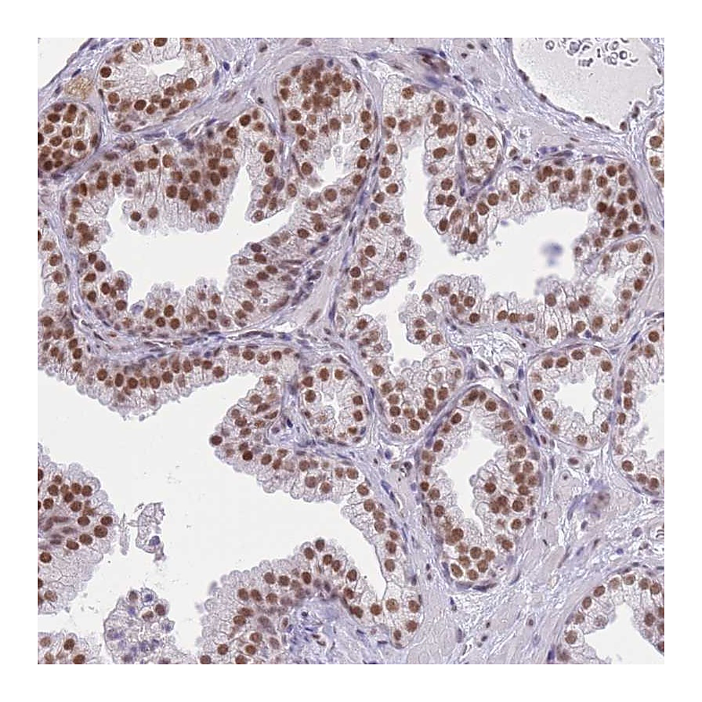 Atlas Antibodies Anti-ZBED5 Antibody