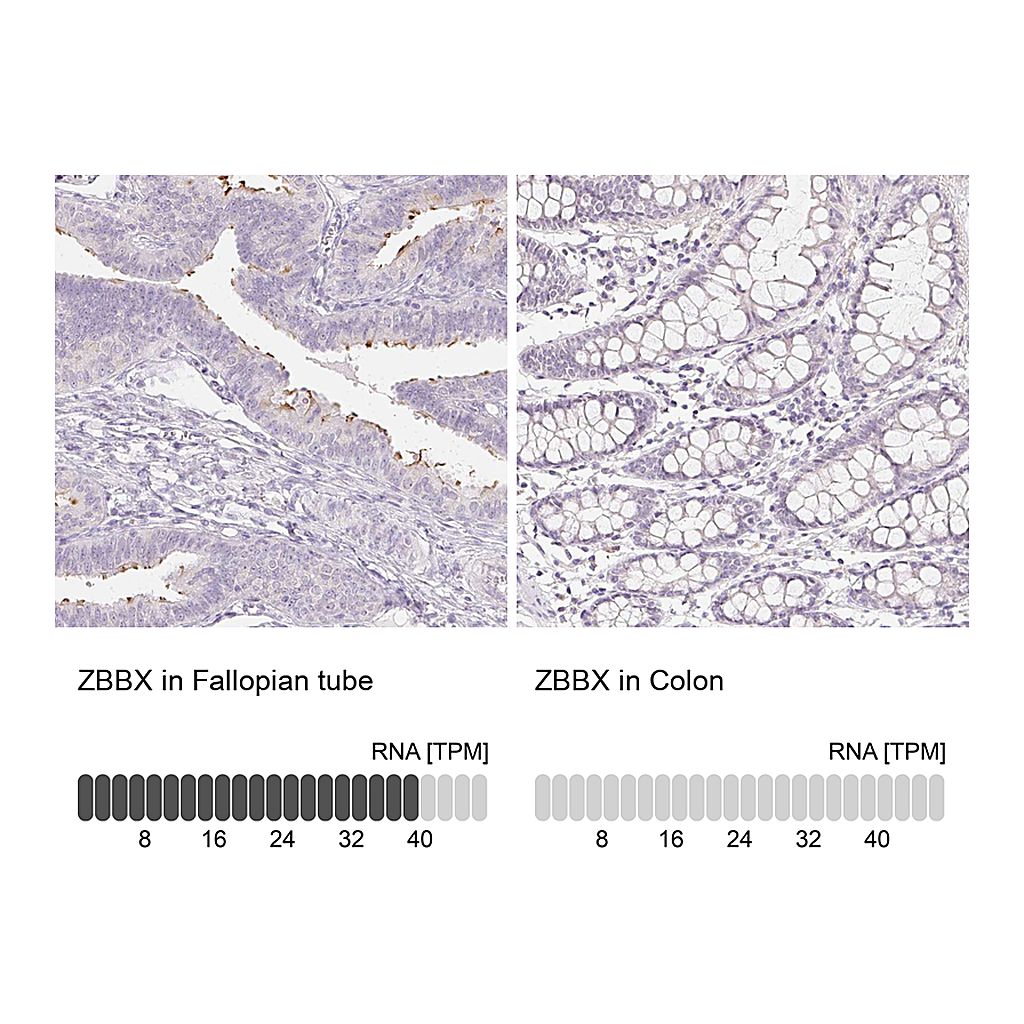 Atlas Antibodies Anti-ZBBX Antibody