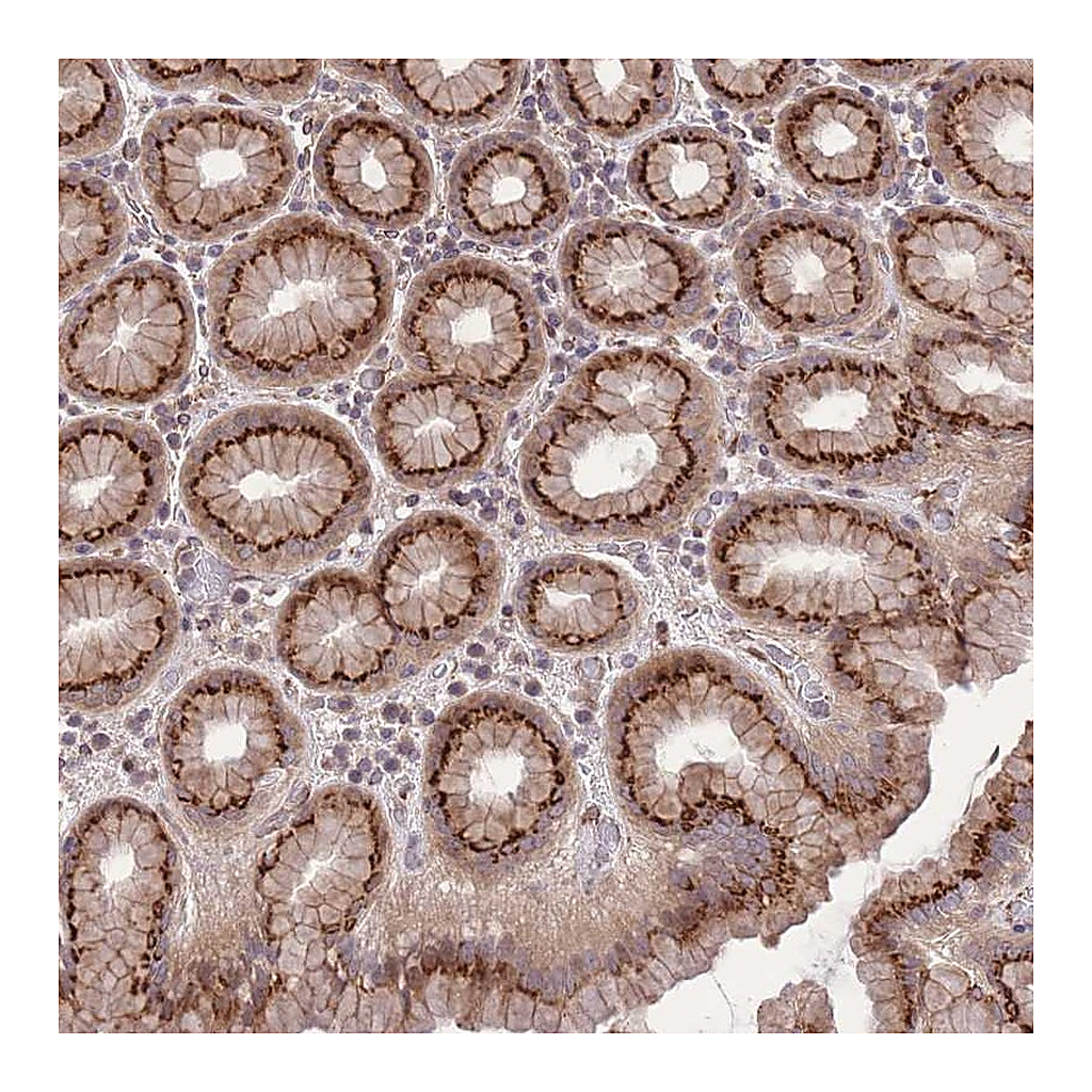 Atlas Antibodies Anti-ZBED5 Antibody