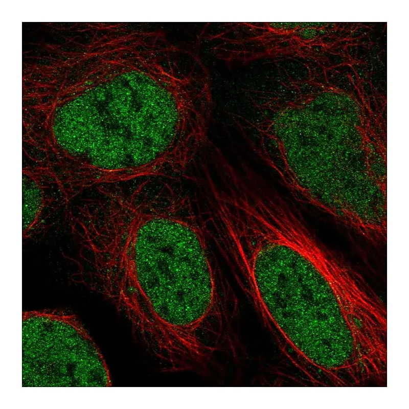 Atlas Antibodies Anti-ZBTB10 Antibody