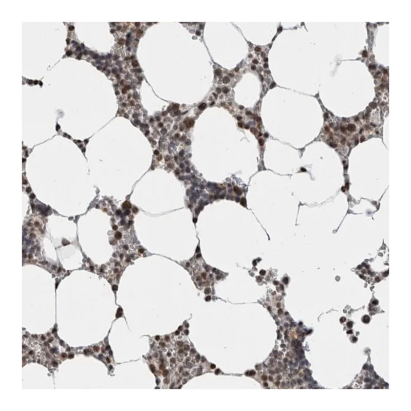 Atlas Antibodies Anti-ZBTB11 Antibody