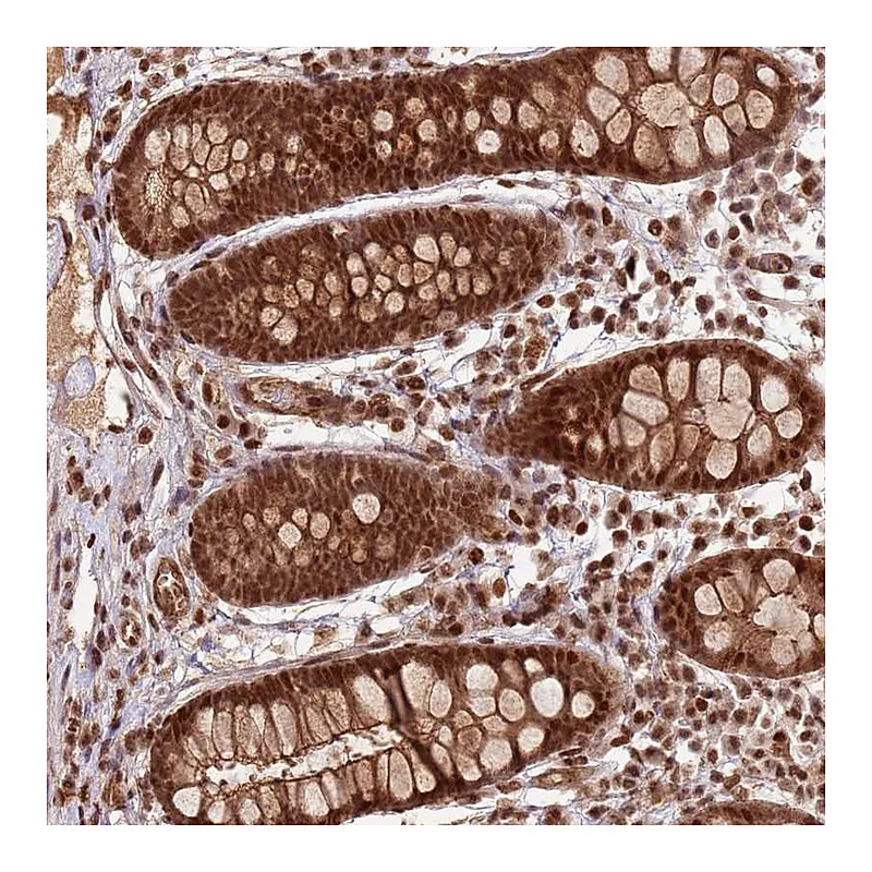 Atlas Antibodies Anti-ZBTB12 Antibody