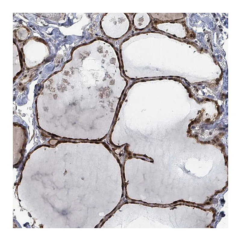 Atlas Antibodies Anti-ZBTB14 Antibody