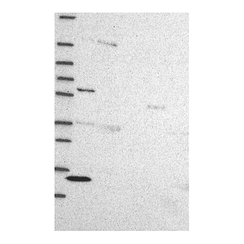 Atlas Antibodies Anti-ZBTB1 Antibody