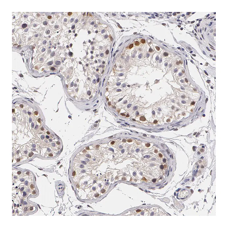 Atlas Antibodies Anti-ZBTB16 Antibody