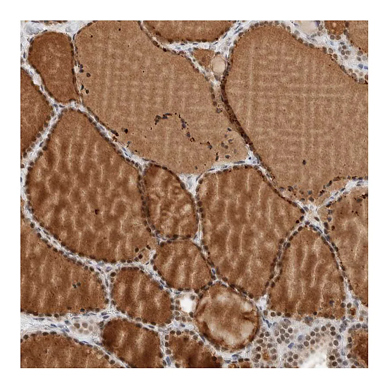 Atlas Antibodies Anti-ZBTB2 Antibody