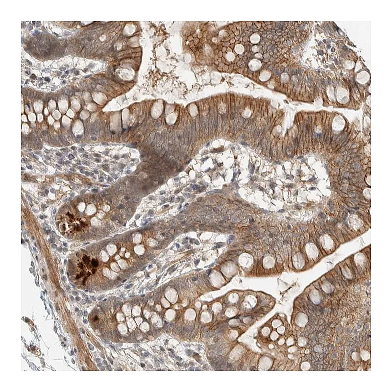 Atlas Antibodies Anti-ZBTB2 Antibody