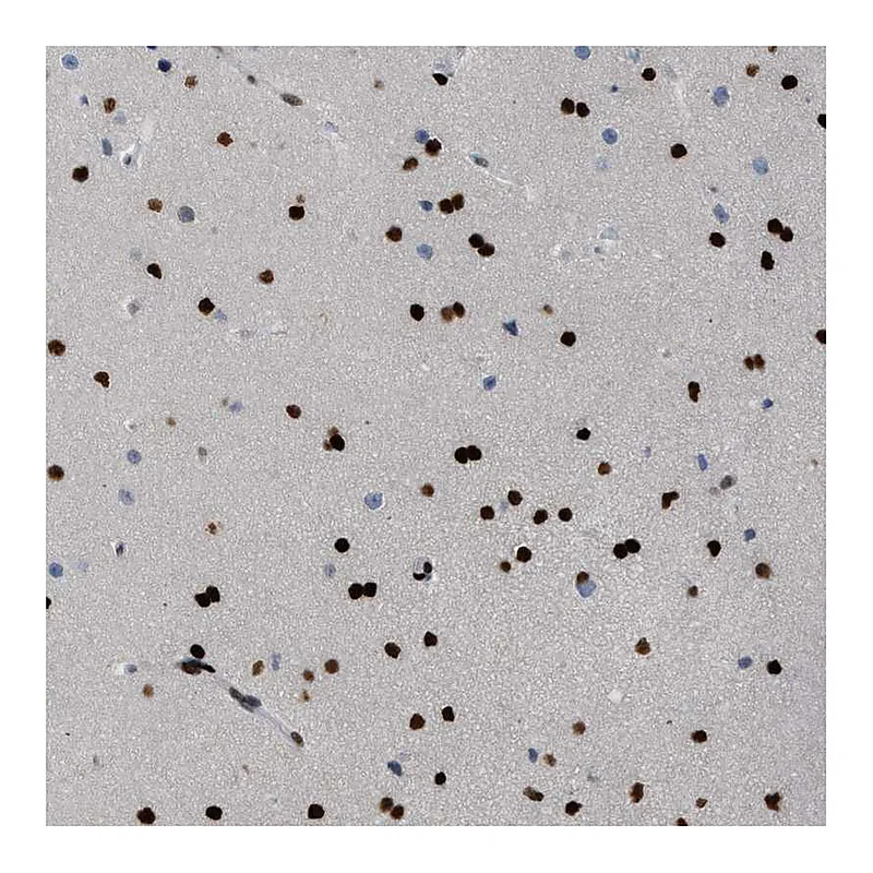 Atlas Antibodies Anti-ZBTB20 Antibody