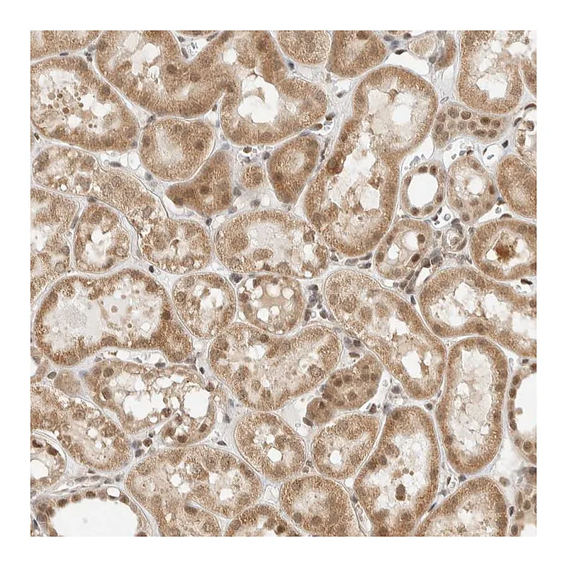 Atlas Antibodies Anti-ZBTB2 Antibody