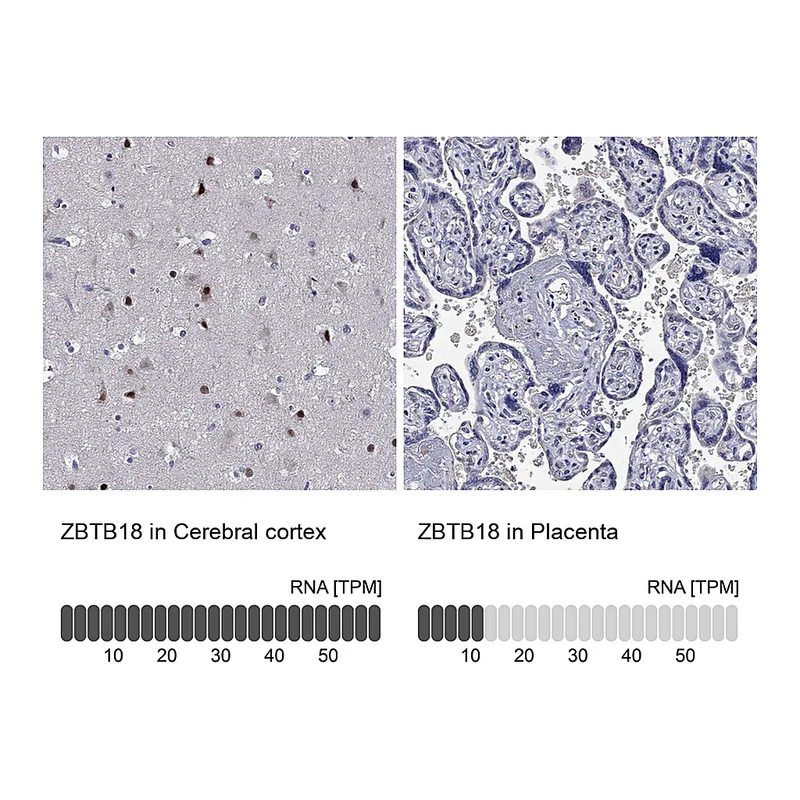 Atlas Antibodies Anti-ZBTB18 Antibody