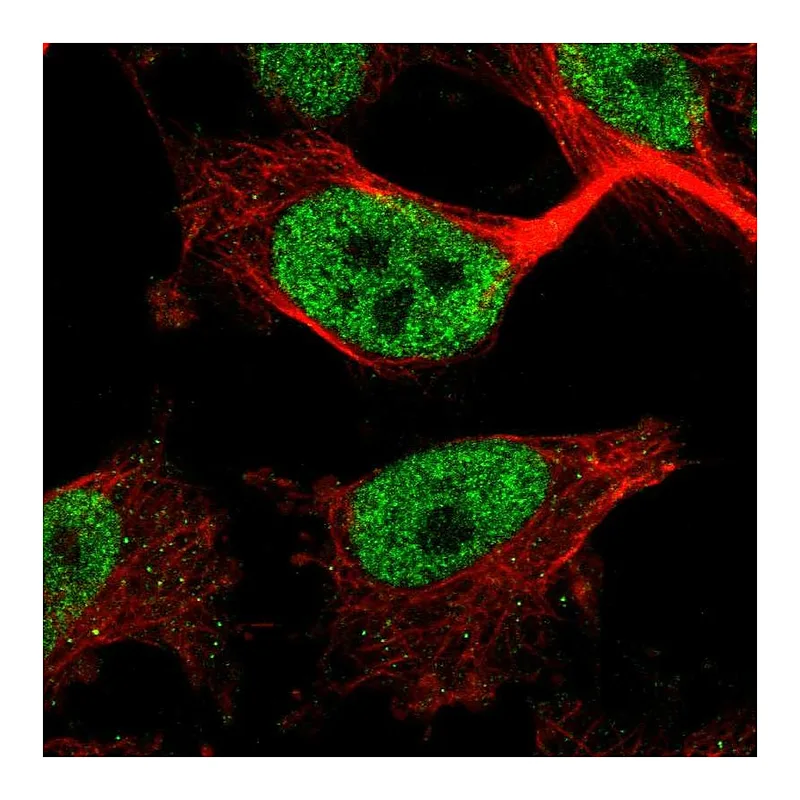 Atlas Antibodies Anti-ZBTB21 Antibody