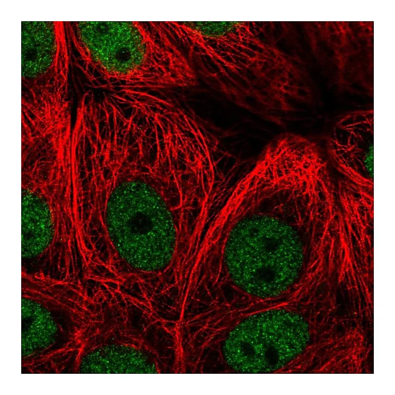 Atlas Antibodies Anti-ZBTB21 Antibody