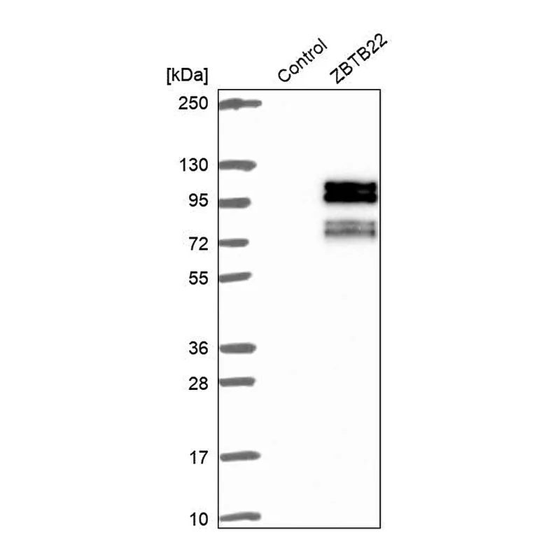 Atlas Antibodies Anti-ZBTB22 Antibody