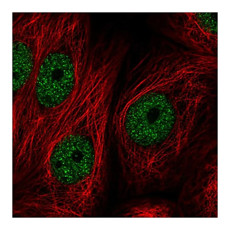 Atlas Antibodies Anti-ZBTB21 Antibody