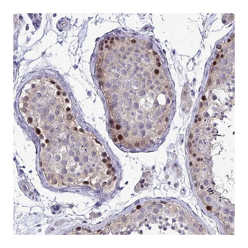 Atlas Antibodies Anti-ZBTB25 Antibody