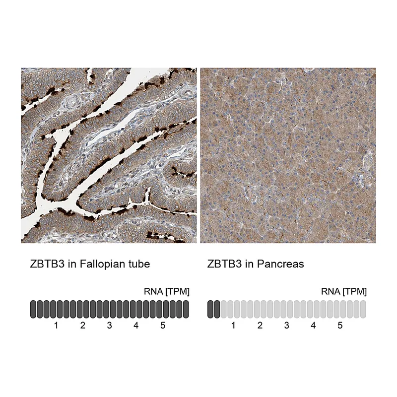 Atlas Antibodies Anti-ZBTB3 Antibody