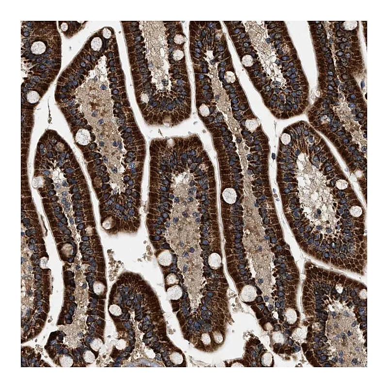 Atlas Antibodies Anti-ZBTB26 Antibody