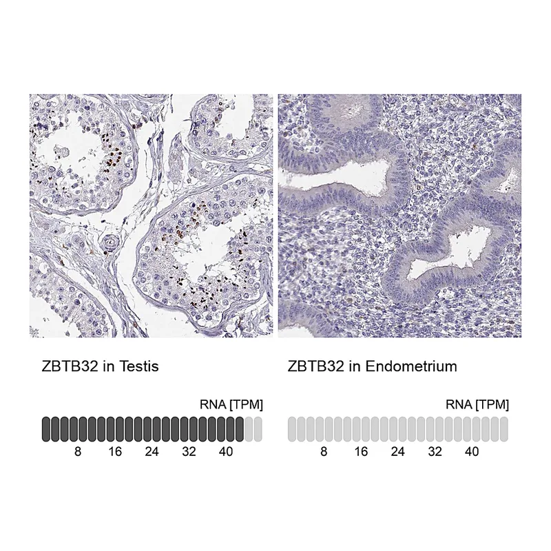 Atlas Antibodies Anti-ZBTB32 Antibody