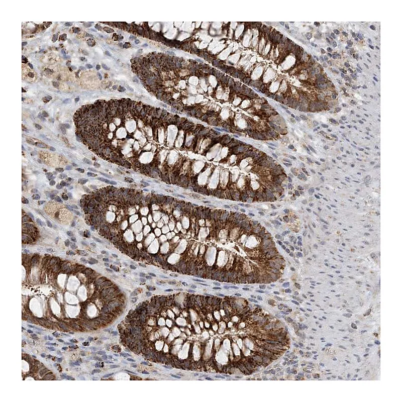 Atlas Antibodies Anti-ZBTB3 Antibody