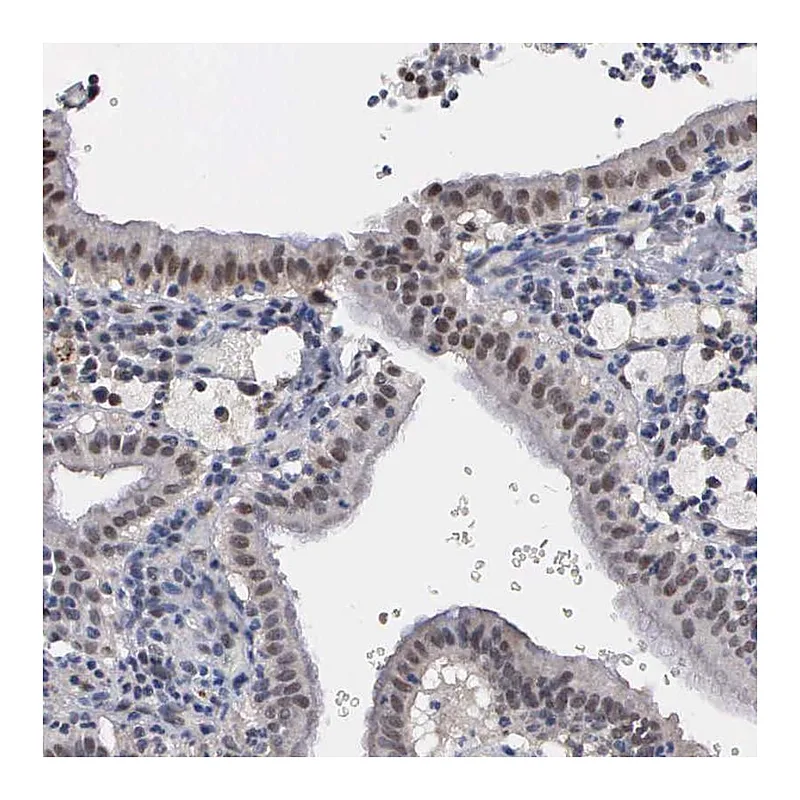 Atlas Antibodies Anti-ZBTB33 Antibody