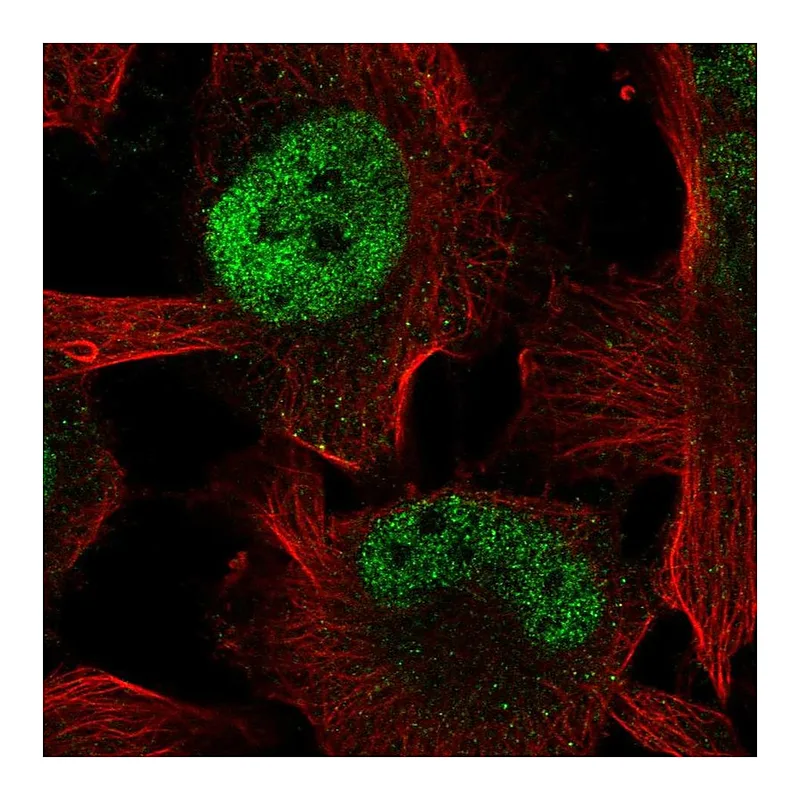 Atlas Antibodies Anti-ZBTB38 Antibody