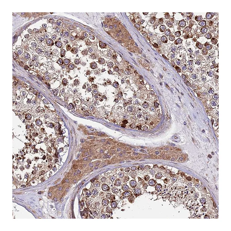 Atlas Antibodies Anti-ZBTB39 Antibody