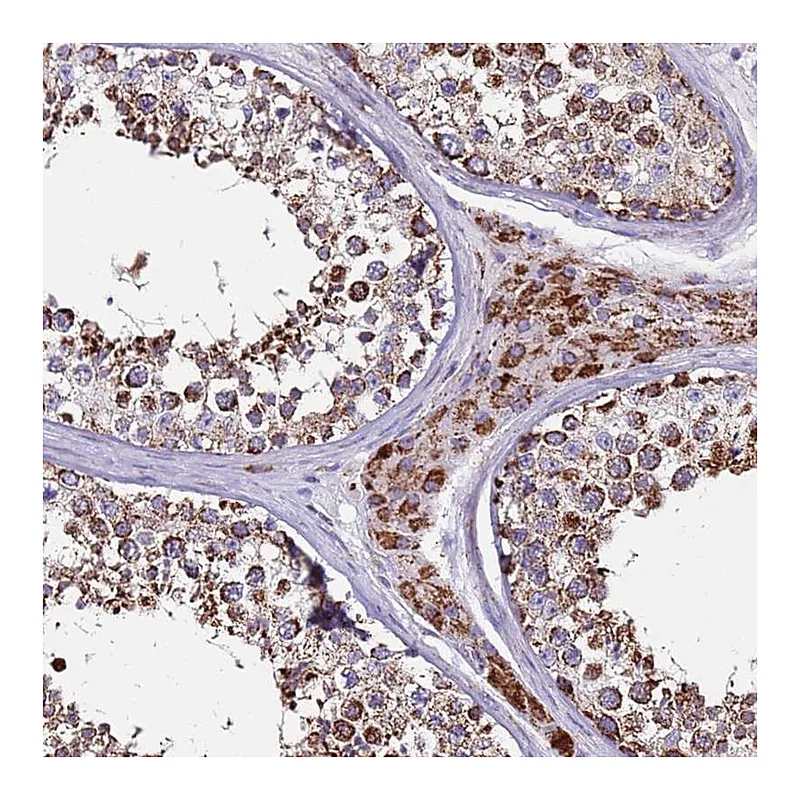 Atlas Antibodies Anti-ZBTB39 Antibody