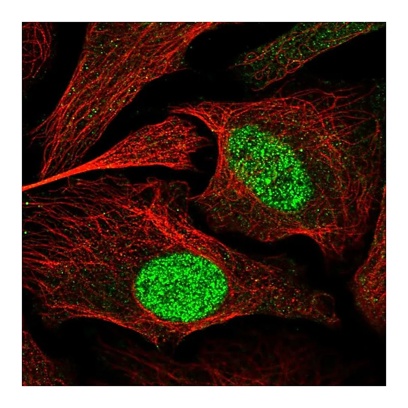 Atlas Antibodies Anti-ZBTB34 Antibody