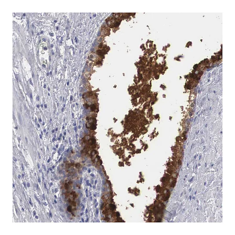 Atlas Antibodies Anti-ZBTB42 Antibody