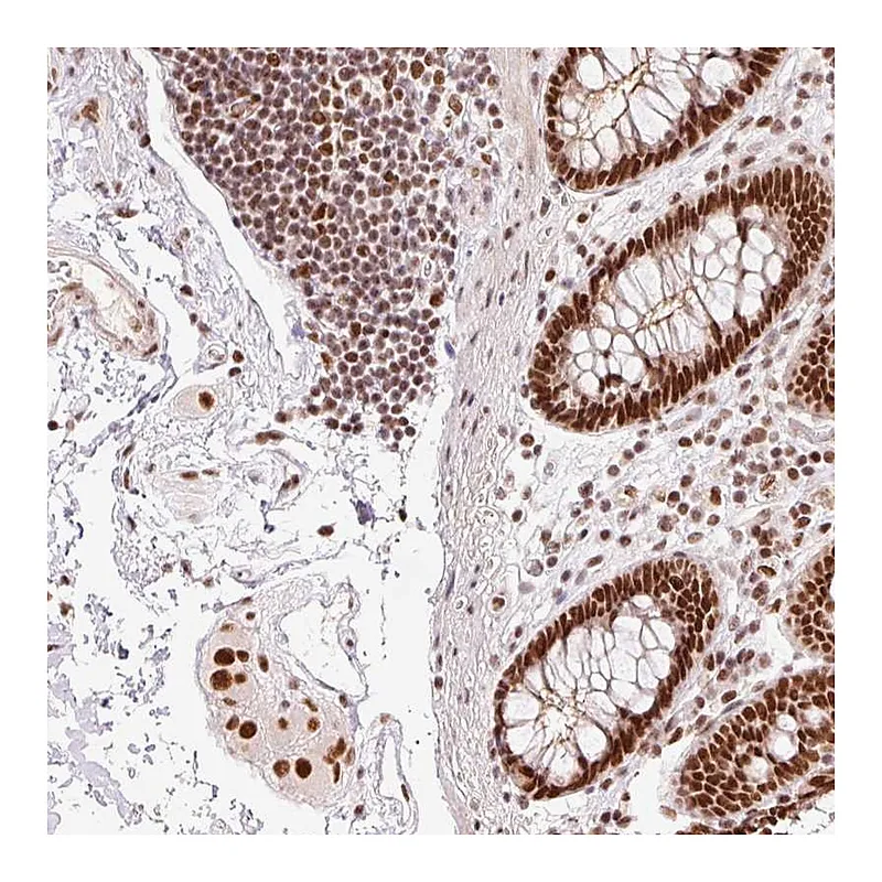 Atlas Antibodies Anti-ZBTB44 Antibody