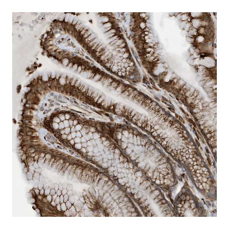 Atlas Antibodies Anti-ZBTB45 Antibody